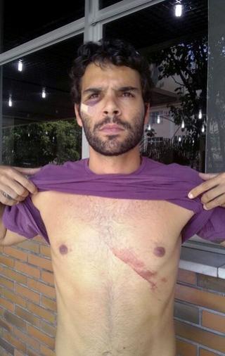 Torcedor do Vasco ferido em Joinville foi atacado antes da partida